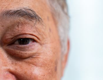 Whitewater Eye Centers